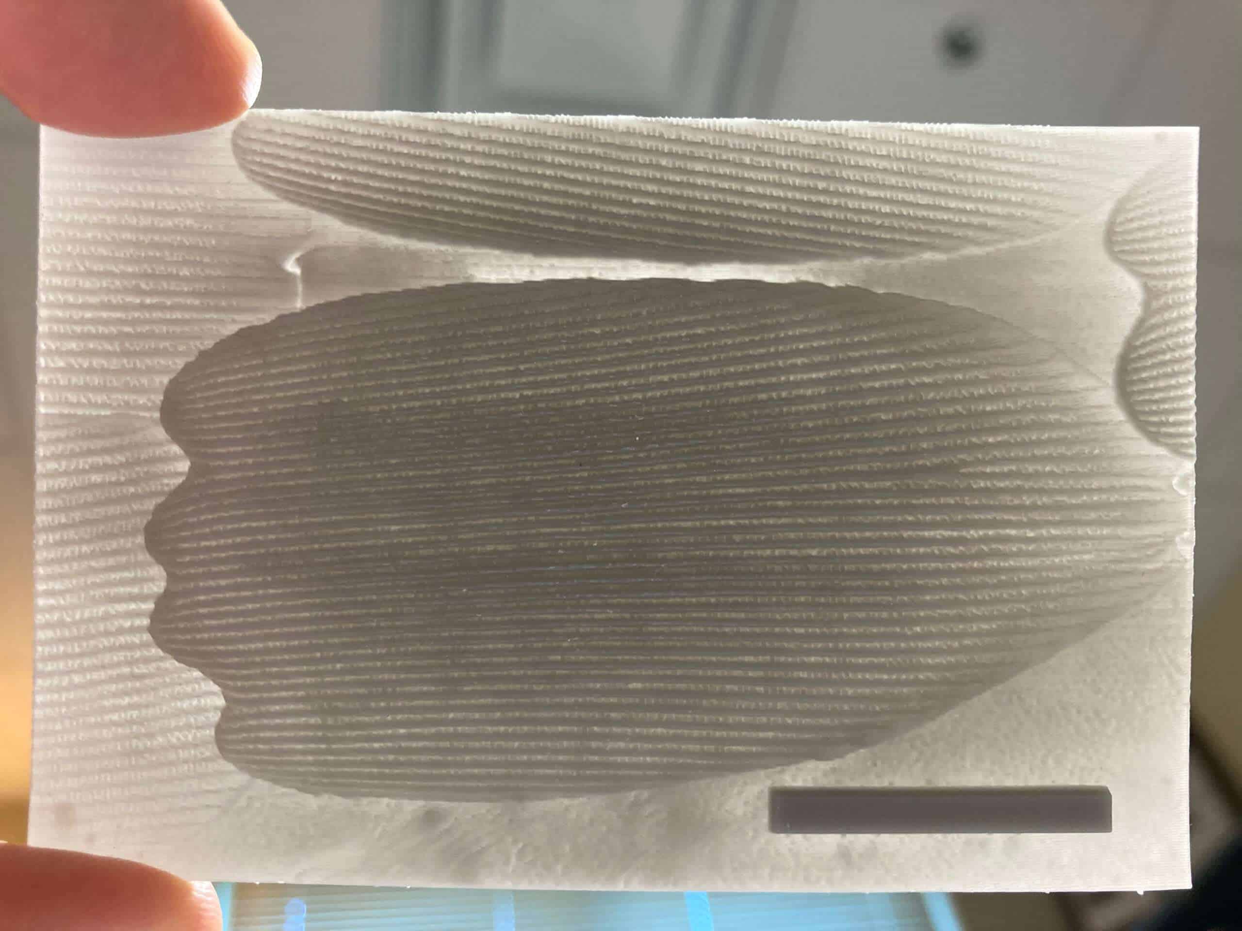 هل ستمكن المكفوفون من الرؤية حقاً؟