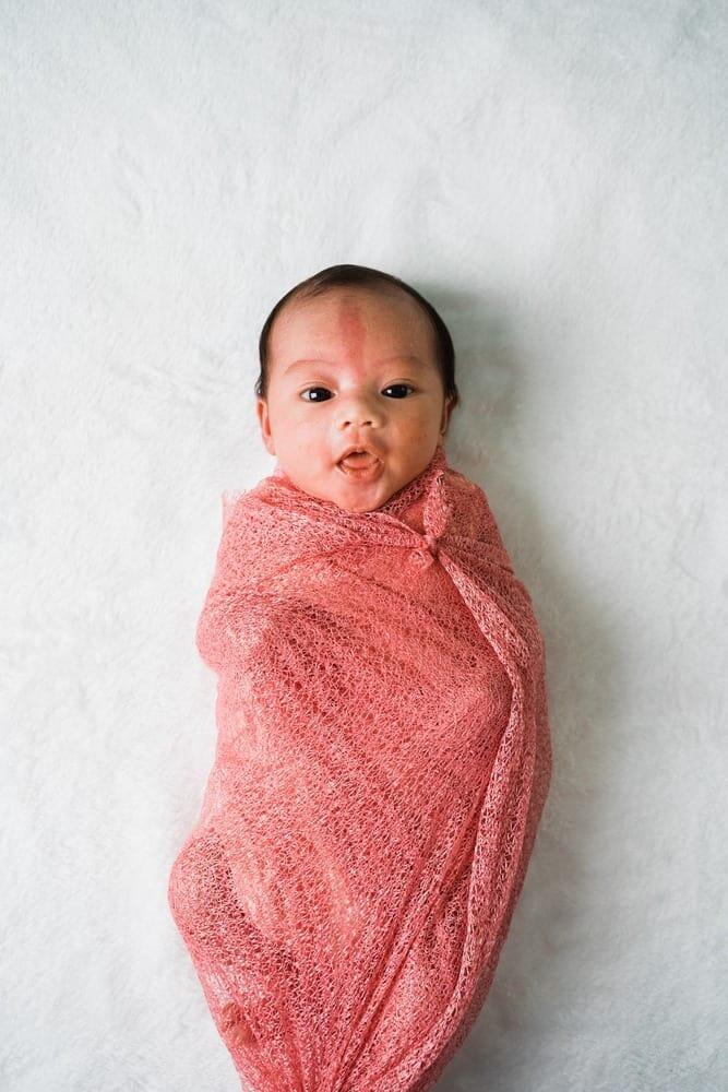 وحمة عضة اللقلق