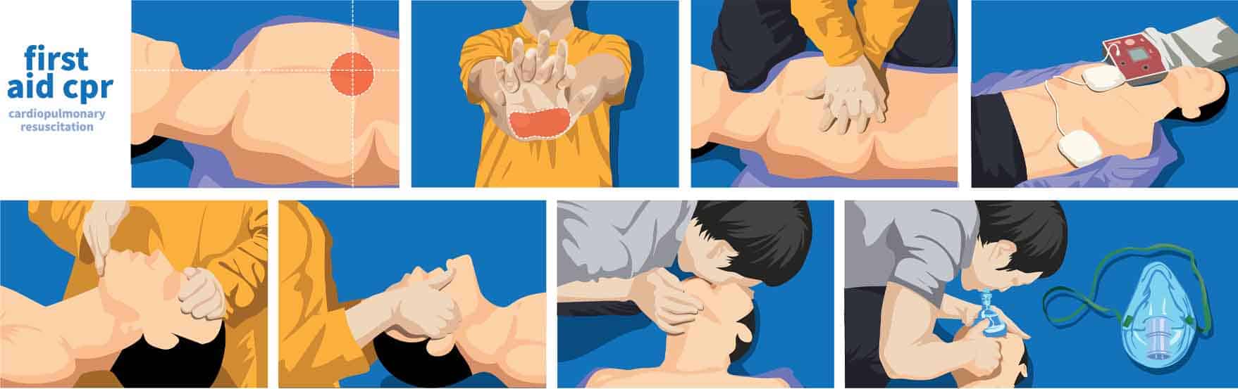 خطوات الإنعاش القلبي الرئوي