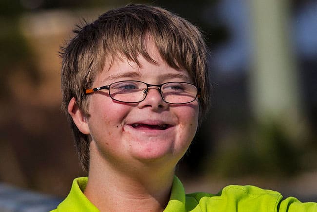 متلازمة داون, أطفال, صحة